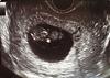    
: DSC00796 (1).JPG
: 548
:	46.6 
ID:	3140